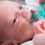 Close-up of a newborn baby with medical tape on the face.