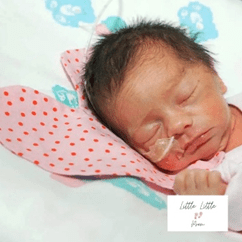 Newborn baby peacefully sleeping with a nasal tube for breathing support.